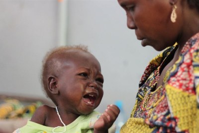 A mother watches her baby at a hospital in Cameroon’s Far North Region where many children under five have been afflicted by severe malnutrition. Strengthening healthcare is a key recommendation in a report by the President’s Advisory Council on Doing Business in Africa.