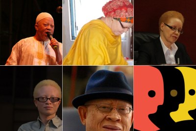 UN Albinism Awareness Day